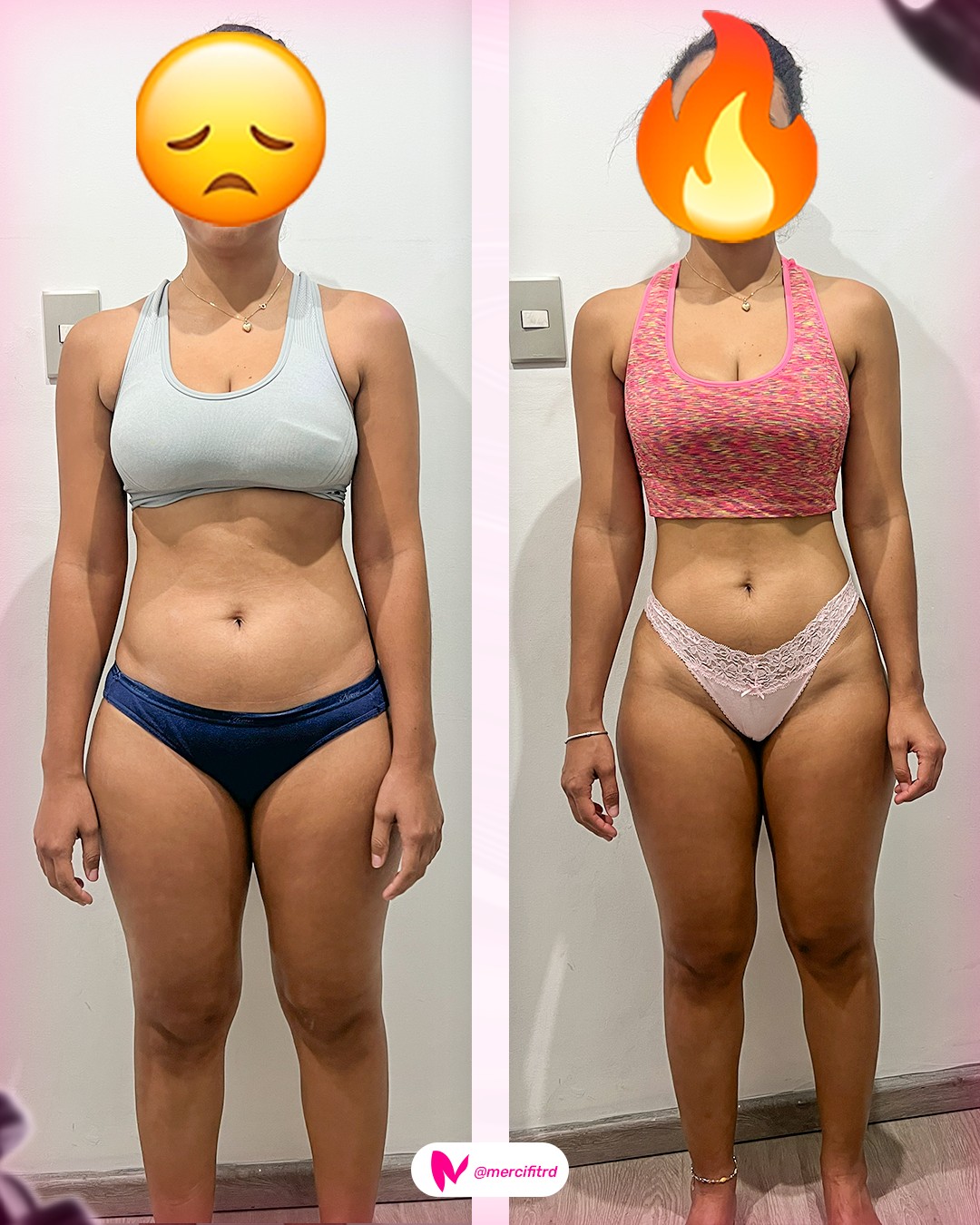Transformación Mercifit — Antes y Después