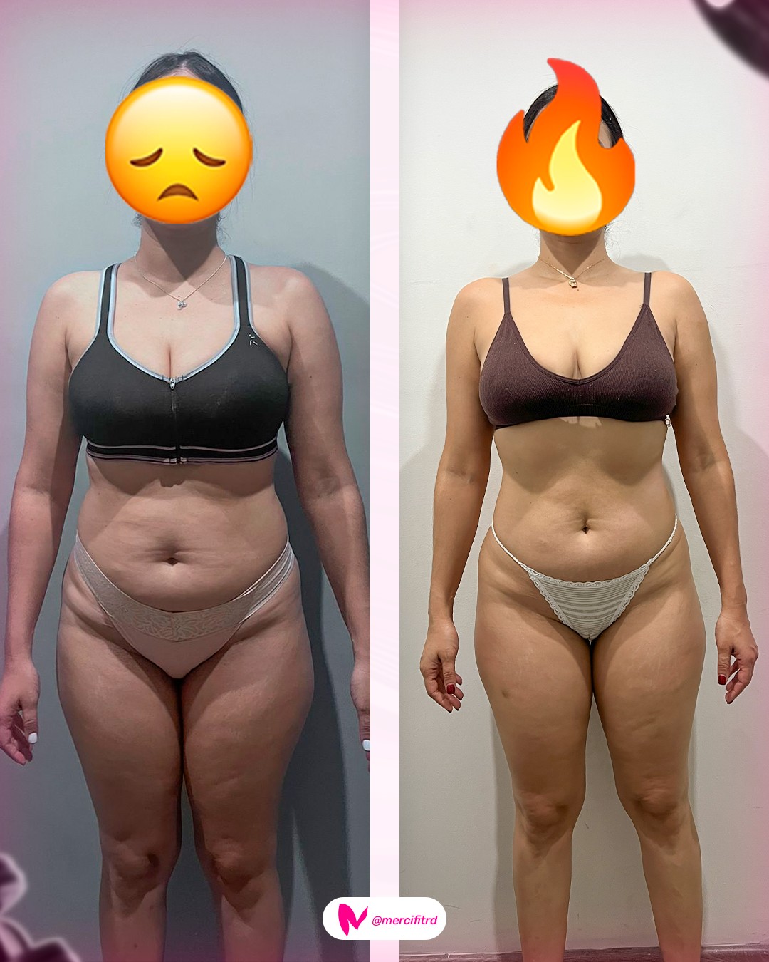 Transformación Mercifit — Antes y Después